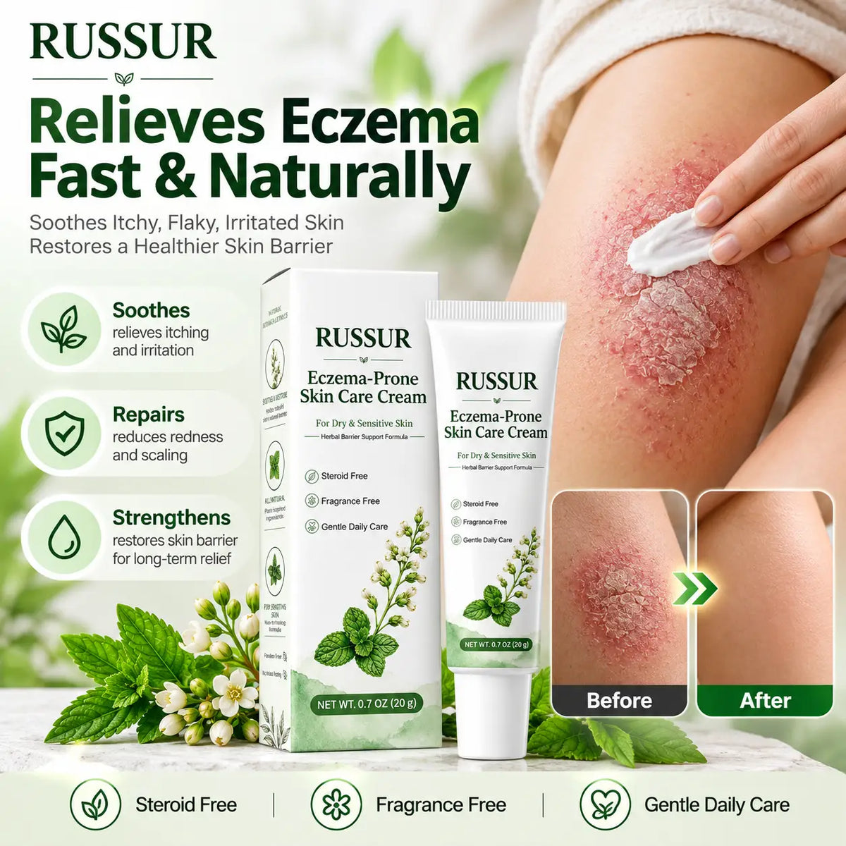 🌿 RUSSUR Skin Comfort Cream for Dry, Flaky & Psoriasis-Prone Skin